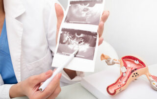 Os exames de imagem no diagnóstico de Endometriose Ovariana