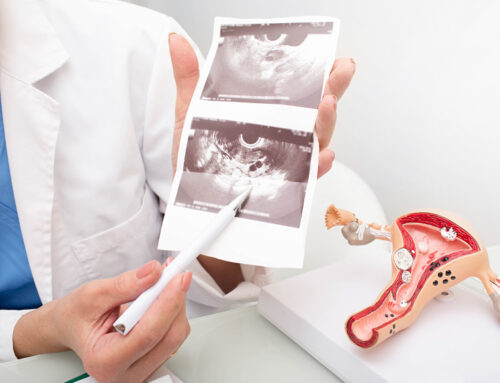 Os exames de imagem no diagnóstico da Endometriose Ovariana