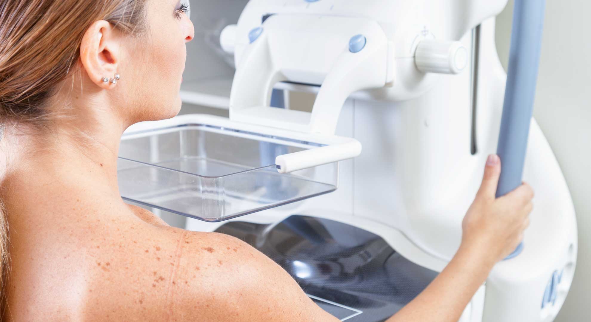 Os métodos de imagem no rastreamento do câncer de mama