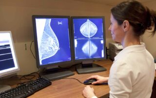 Câncer de mama: entenda a classificação BIRADS