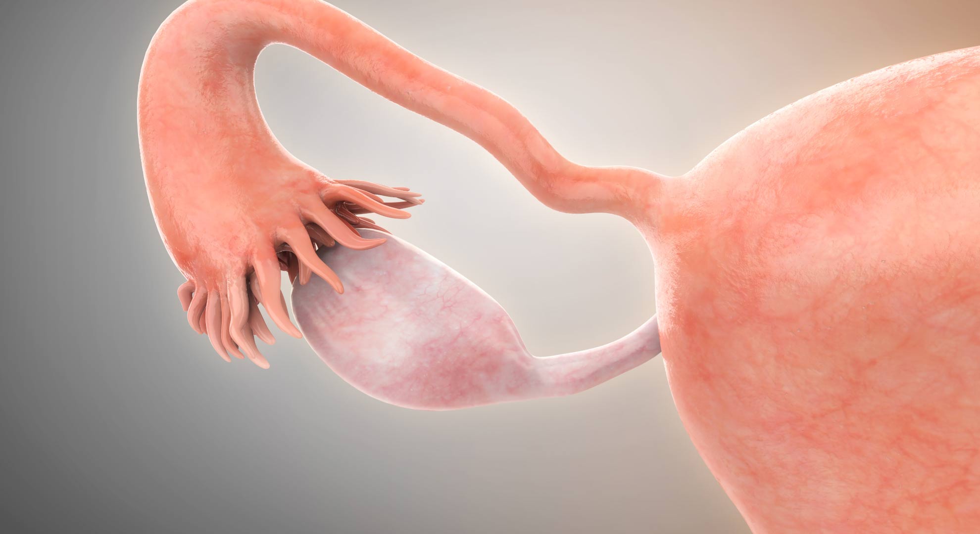 Conheça os tipos de cistos ovarianos