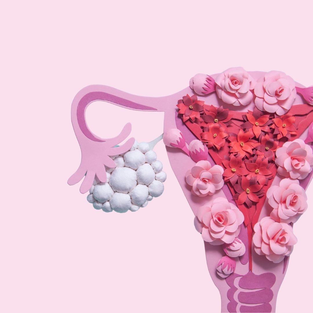 Como é feito o preparo do ultrassom transvaginal para a endometriose? Como é feito o preparo do ultrassom transvaginal para a endometriose?